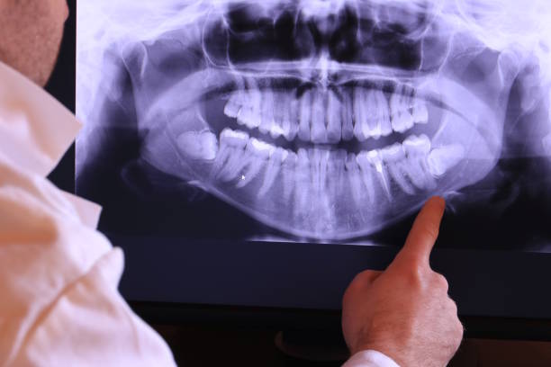 Best After-Hours Emergency Dentist in Chalfant, CA
