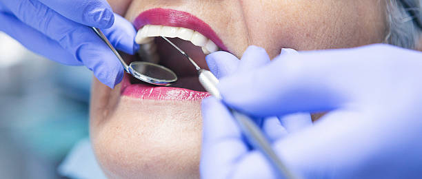 Best Same-Day Emergency Dentist in Chalfant, CA